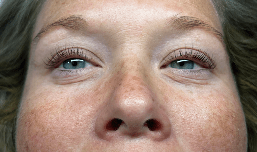 LASH LIFTS